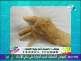 ست الستات - الحل النهائي للقضاء على مشاكل وآلام المفاصل والروماتيزم