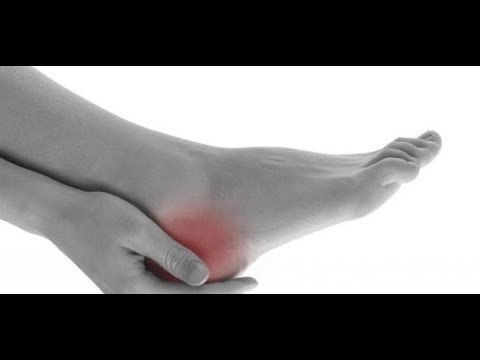 صدى البلد | سر انتشار الأملاح بين المصريين.. تعرف على حيلة سحرية للتخلص منها