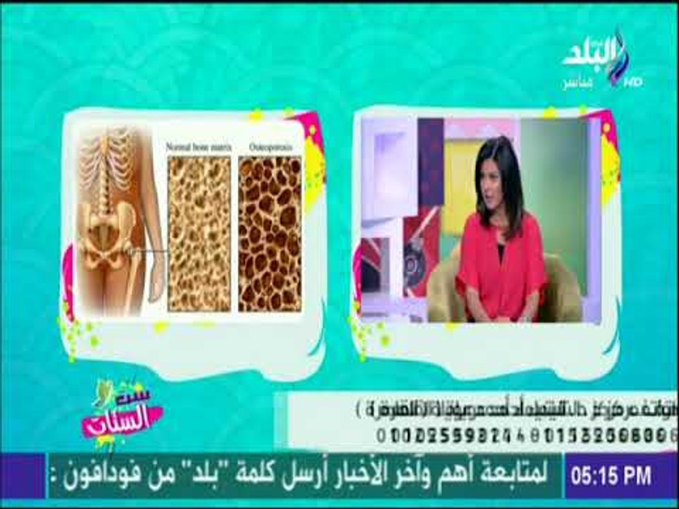 ست الستات - علاج نهائي لمشاكل العظام عند السيدات خاصةً هشاشة العظام