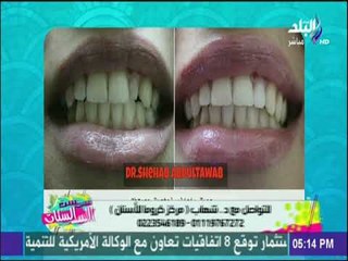 ست الستات - تعرّف على مشاكل الأسنان التي تحتاج إلى عمليات تجميل