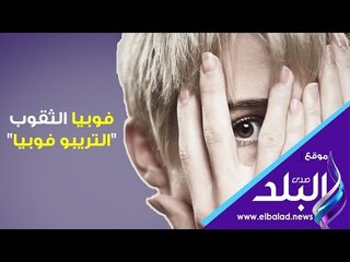صدي البلد | فوبيا الثقوب " التريبو فوبيا "