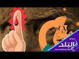 صدي البلد | الخوف من الدم : أسباب الهيموفوبيا وطرق علاجها