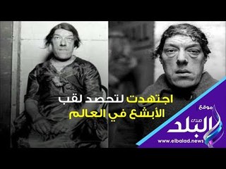 صدي البلد | قصة أبشع إمرأة في العالم .. هكذا ستتعاطف معها