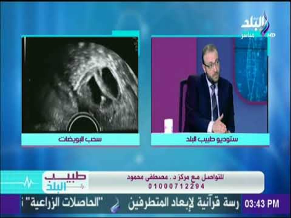 تعرف على معايير نجاح عملية الحقن المجهري مع د.مصطفى محمود | طبيب البلد