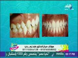 ست الستات - تعرف على أنواع تقويم الأسنان وطرق تركيبه بدون ألم مع مع د.ماجد زهدي