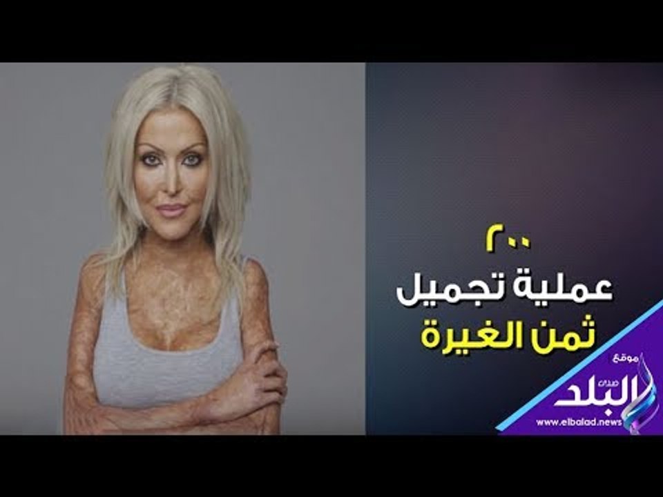 صدي البلد | خضعت لـ 200 عملية تجميل بسبب الغيرة