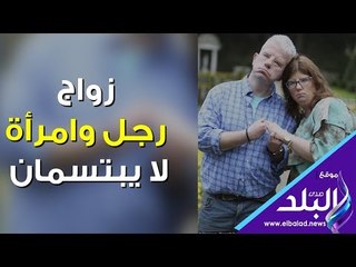 صدي البلد | زواج رجل وامرأة لا يبتسمان‎