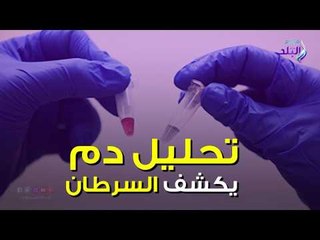 صدي البلد | تحليل دم يكشف السرطان