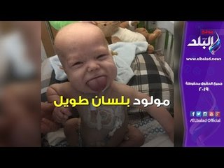 صدى البلد | مولود بلسان طويل