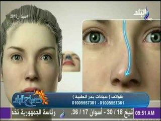 Télécharger la video: صباح البلد - هكذا تتم عملية تجميل الانف .. د.أشرف سمعان