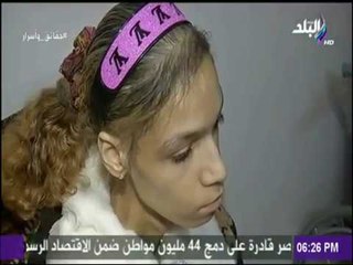 حقائق وأسرار| بكري يعرض مأساة شقيقتين ..«يحتاجون الى 30 مليون دولار لعلاجهم من مرض ضمور العضلات»