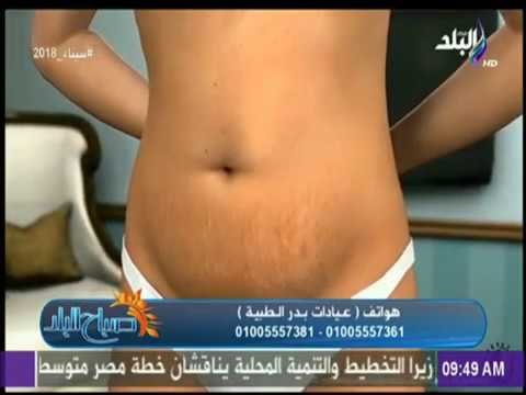 صباح البد - تعرف على الجديد فى عمليات شفط الدهون ونحت وتنسيق الجسم