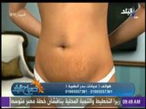 صباح البد - تعرف على الجديد فى عمليات شفط الدهون ونحت وتنسيق الجسم