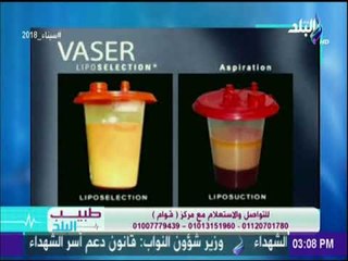 عملية نحت الجسم وأنواعها ومميزاتها مع الدكتور محمد الفولى