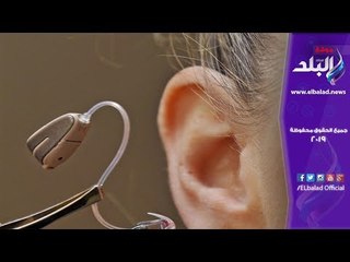 صدي البلد | وزير سابق :  الدولة اصبحت تتكفل بـ ١٥٠٠ عملية زراعة قوقعة سنويا