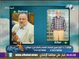 صباح البلد - تعرف علي أحدث طرق انقاص الوزن مع الدكتور كريم صبري