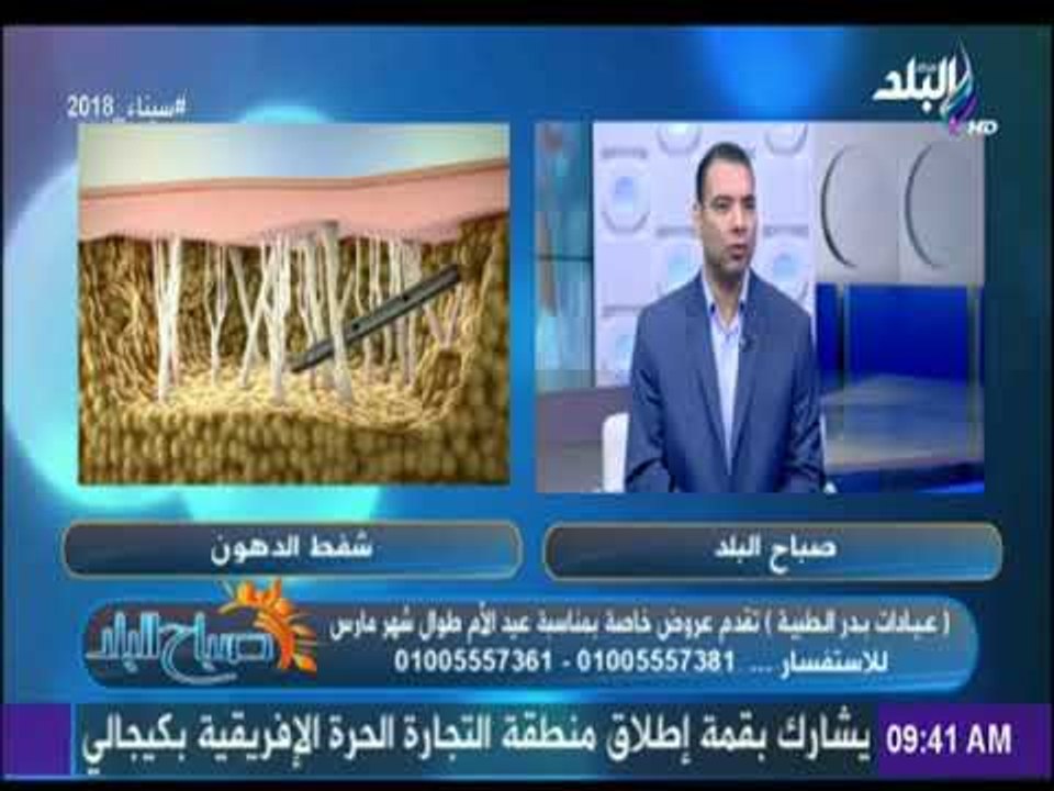 صباح البلد - قبل إجراء العملية.. أربعة فروق بين شفط الدهون وشد البطن تعرف عليها