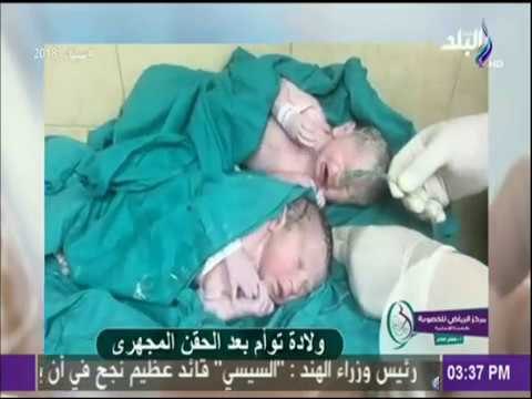 طبيب البلد - شاهد بالفيديو..كيف تتم عملية الحقن المجهري الولادة الناتجة عن التلقيح الصناعى