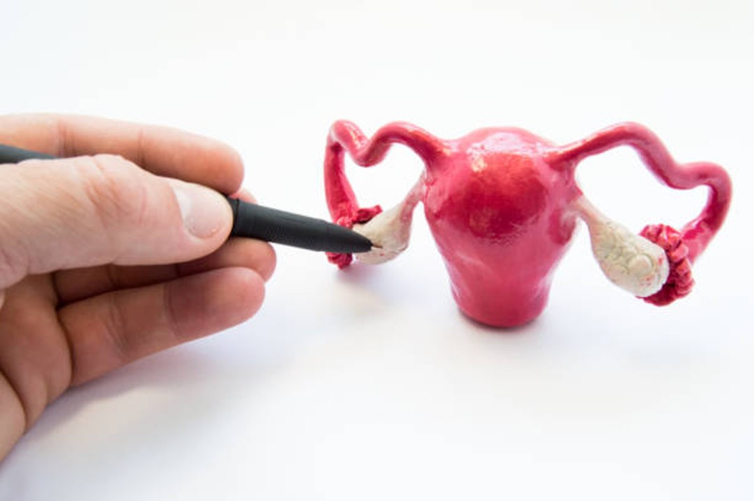 Der künstliche Eierstock für unfruchtbare Frauen