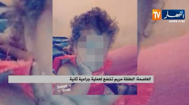 الطفلة مريم تخضع لعملية جراحية ثانية