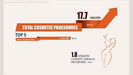 This Is What Plastic Surgery Americans Are Having