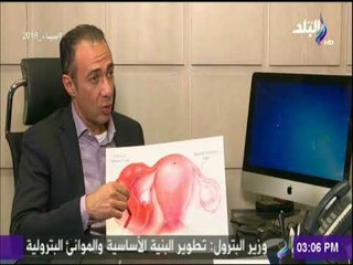 طبيب البلد - انسداد قناة فالوب ودور الحقن المجهري في حلها - د. شريف باشا