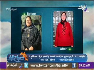 صباح البلد - لقاء خاص مع الدكتور كريم صبري وحديث هام حول احدث طرق علاج السمنة
