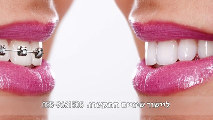יישור שיניים  בנתניה |
