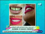 ست الستات - تجميل الاسنان مع د. امجد رسلان