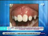 طبيب البلد - نصائح لحماية أسنان الأطفال مع الدكتورة سماح البسيونى