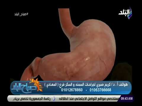 صباح البلد - لقاء خاص مع الدكتور كريم صبري وحديث خاص عن افضل طرق خسارة الوزن الزائد