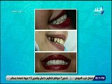 ست الستات - تصميم الابتسامة وخطوات تجميل الاسنان - د. امجد رسلان