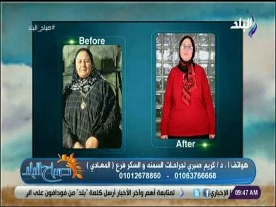 صباح البلد - أحدث تقنيات التخسيس و نحت القوام مع الدكتور كريم صبري