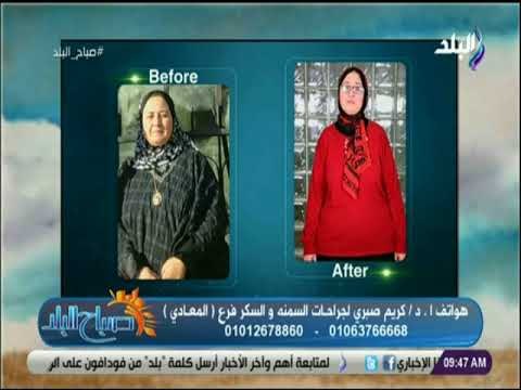 صباح البلد - أحدث تقنيات التخسيس و نحت القوام مع الدكتور كريم صبري