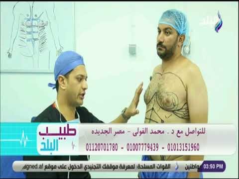 طبيب البلد - نحت القوام بالفيزر والجى بلازما مع د. محمد الفولي