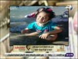 حقائق واسرار - بكري: الرئيس السيسي أمر بعلاج الطفلة مروة على نفقة الدولة