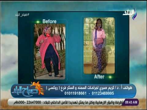 صباح البلد - تعرف على جراحات السمنة الحديثة وأنظمة الرجيم المختلفة مع الدكتور كريم صبري
