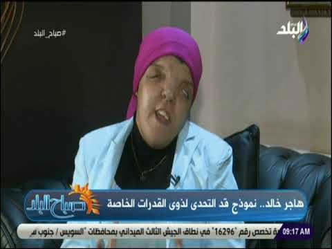 صباح البلد - هاجر خالد .. نموذج قد التحدي لذوي القدرات الخاصة