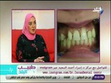 طبيب البلد - الفرق بين تركيب وتقويم الأسنان..وكيفية الحصول على ابتسامة مثالية مع د. اسراء السعيد