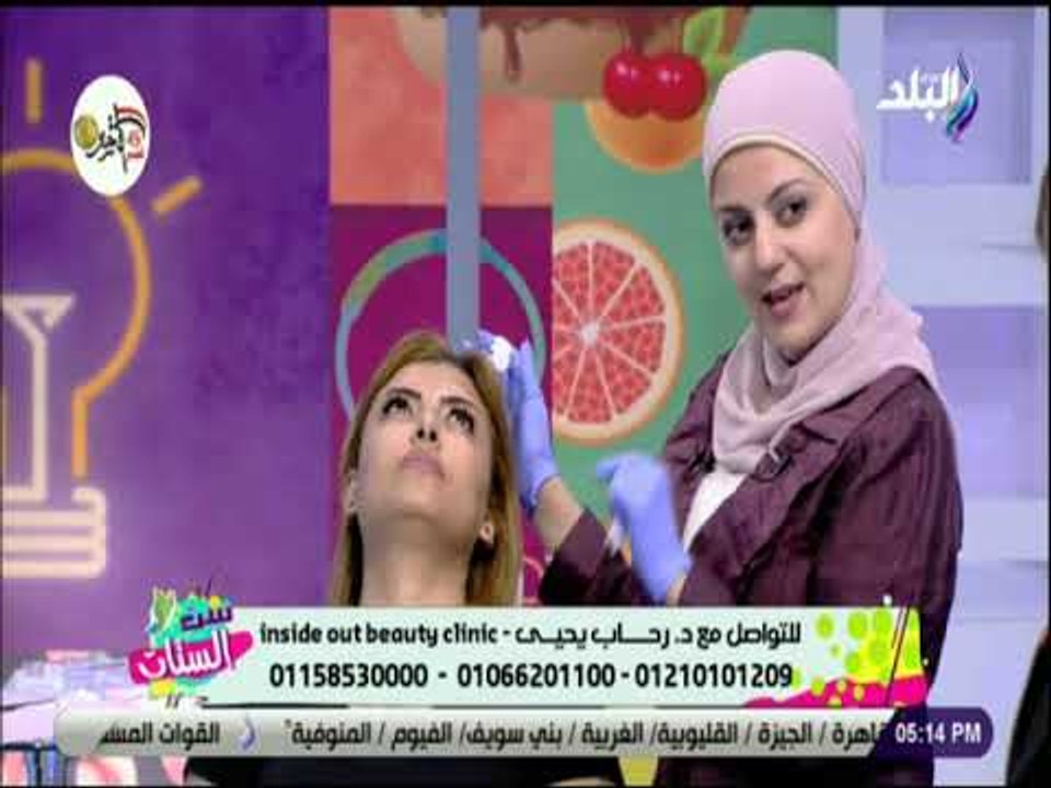 ست الستات - كل ما تريدين معرفته عن حقن "الفيلر"...