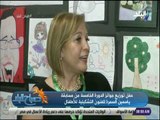 صباح البلد - تعرف على ياسمين السمرة ‏.. ومبادرة والدتها لمرضى الجلد الفقاعي