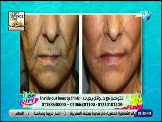 ست الستات - أحدث طرق لشد الجلد المترهل بدون جراحة مع الدكتور وائل يحيى
