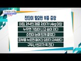 진단이 반드시 필요한 부종의 증상들 [광화문의 아침] 509회 20170623