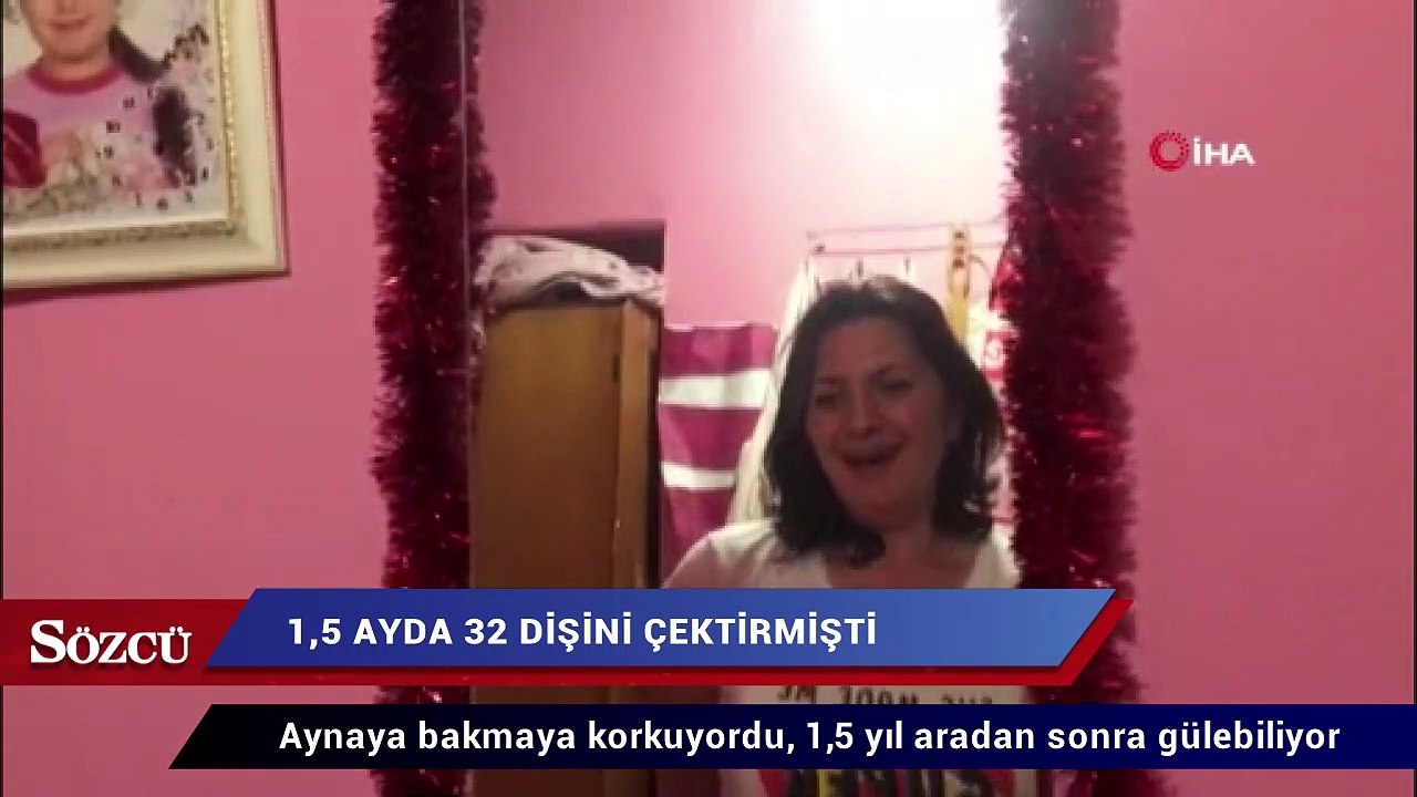 Aynaya bakmaya korkuyordu, 1,5 yıl aradan sonra gülebiliyor
