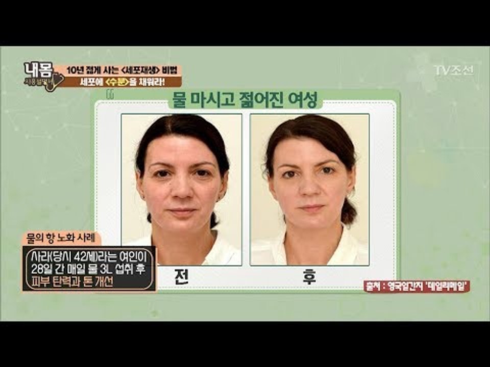 물이 보약! 물 마셔서 젊어진 여성! [내 몸 사용설명서] 158회 20170623
