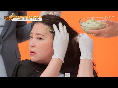 탈모를 잡는 두피 관리법이 따로 있다?! [내 몸 플러스] 64회 20170630