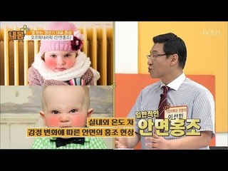 갱년기 대표 증상 ‘안면홍조’ [내 몸 플러스] 66회 20170716