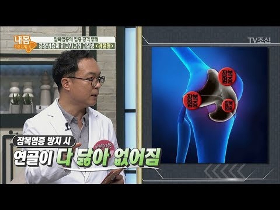 잠복염증의 집중 공격 부위, 연골! 관절염을 조심하라! [내 몸 사용설명서] 166회...