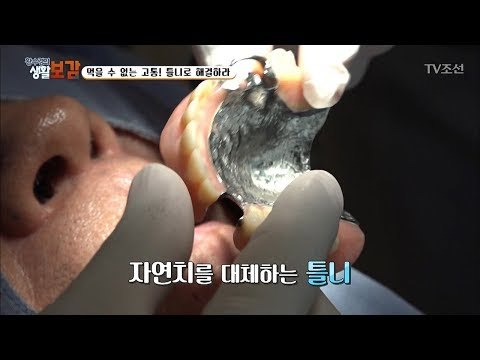 먹을 수 없는 고통 해결! 틀니의 장점은? [황수경의 생활보감] 21회 20170826