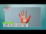 새끼손가락에 통증이? ‘방아쇠수지증후군’ [건강 나눔 프로젝트 청.바.지] 11회 20170915